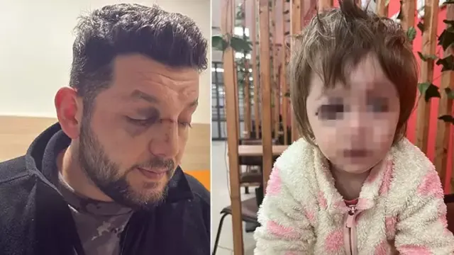 Yalova’da Bebeğin Yaralandığı Komşu Kavgasında İstenen Ceza Belli Oldu: Çocuk Skuter’ı ‘Silah’ Sayıldı